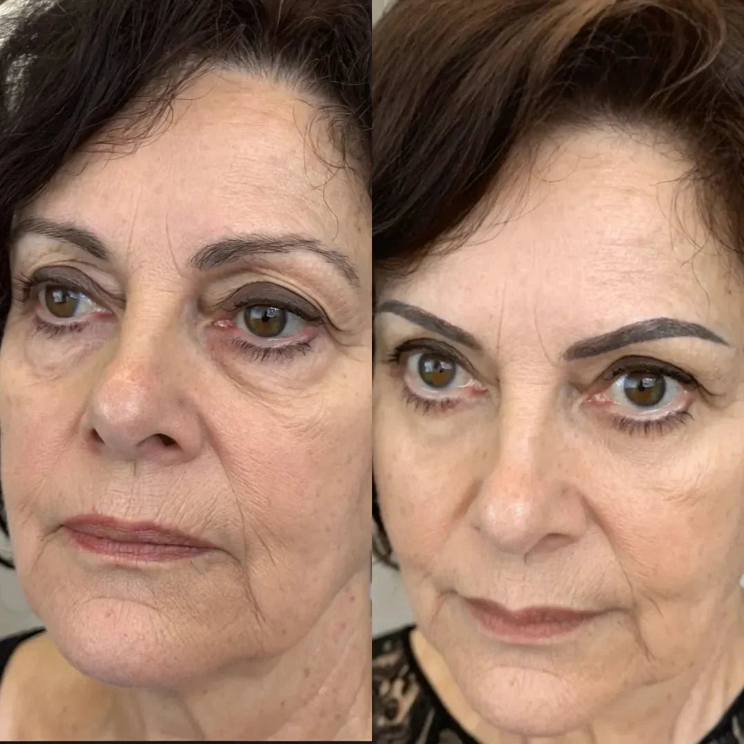 ClearEyes™ | For a Fresh, Youthful Look