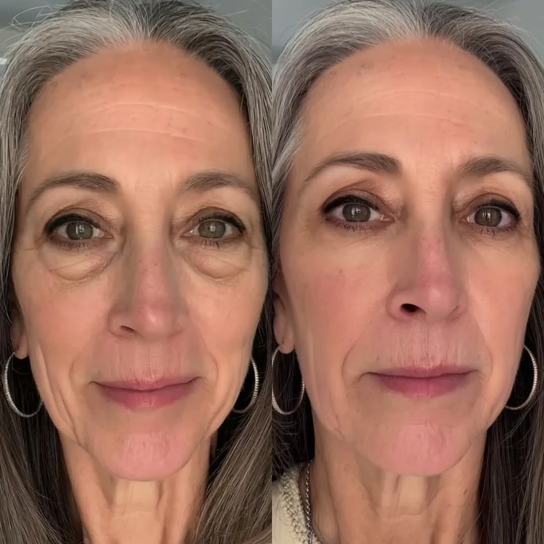 Pure Collagen Wand