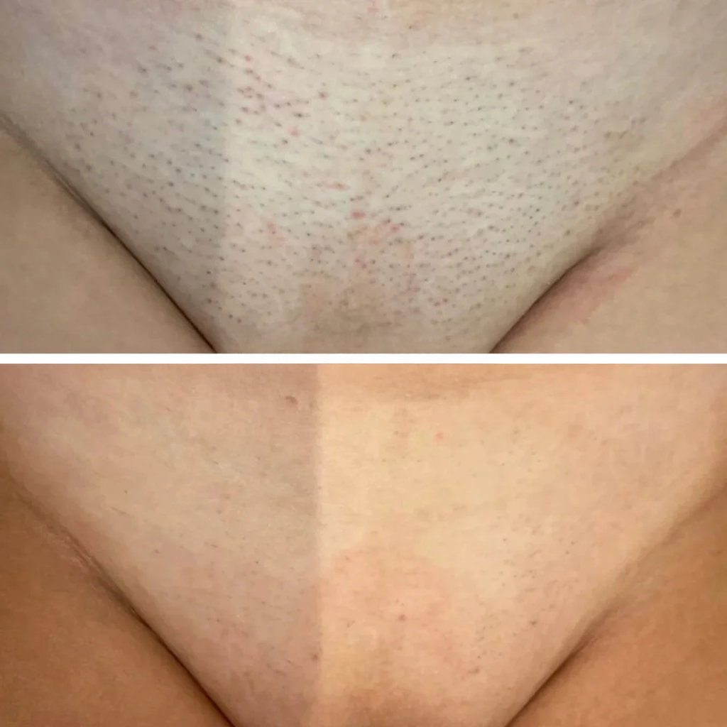 Elara Skin™ | Hair Growth Serum