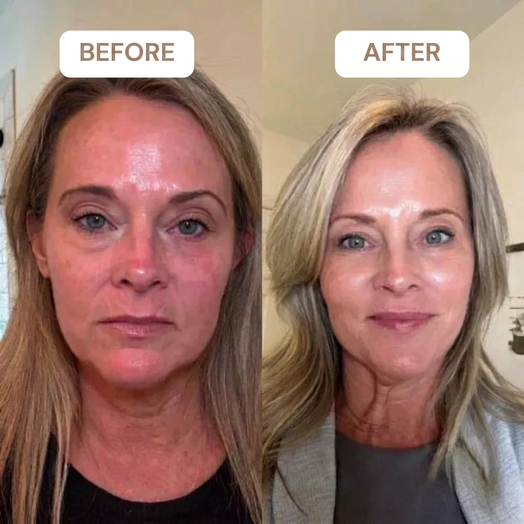 Retinal Shot™ | Anti-Aging Firming Booster